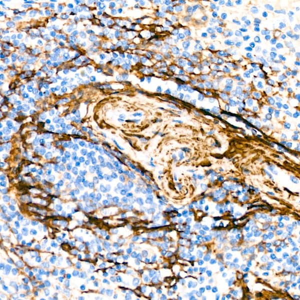 Immunohistochemistry: Actin Antibody (3U6B8) [NBP3-16100] - Immunohistochemistry analysis of paraffin-embedded Human spleen using alpha-Actin-1 Rabbit mAb at dilution of 1:100 (40x lens). Microwave antigen retrieval performed with 0.01M Tris/EDTA Buffer (pH 9.0) prior to IHC staining.