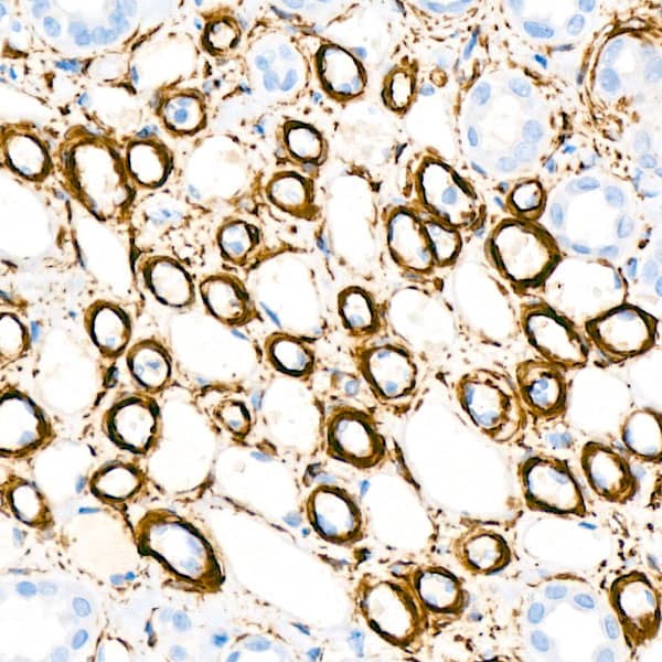 Immunohistochemistry: Actin Antibody (3U6B8) [NBP3-16100] - Immunohistochemistry analysis of paraffin-embedded Human kidney using alpha-Actin-1 Rabbit mAb at dilution of 1:100 (40x lens). Microwave antigen retrieval performed with 0.01M Tris/EDTA Buffer (pH 9.0) prior to IHC staining.