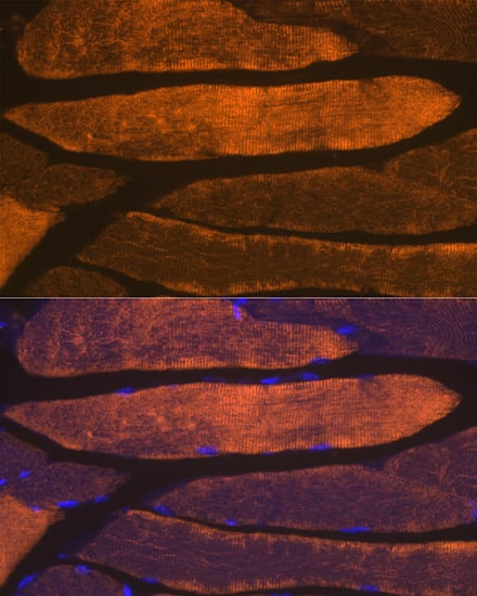 Immunocytochemistry/ Immunofluorescence: Actin Antibody (3U6B8) [NBP3-16100] - Immunofluorescence analysis of paraffin-embedded mouse skeletal muscle using alpha-Actin-1 Rabbit mAb at dilution of 1:100 (40x lens). Secondary antibody: Cy3-conjugated Goat anti-Rabbit IgG (H+L) at 1:500 dilution. Blue: DAPI for nuclear staining.