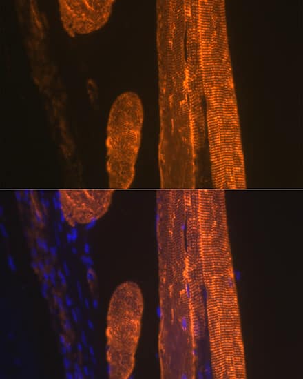 Immunocytochemistry/ Immunofluorescence: Actin Antibody (3U6B8) [NBP3-16100] - Immunofluorescence analysis of paraffin-embedded rat skeletal muscle using alpha-Actin-1 Rabbit mAb at dilution of 1:100 (40x lens). Secondary antibody: Cy3-conjugated Goat anti-Rabbit IgG (H+L) at 1:500 dilution. Blue: DAPI for nuclear staining.