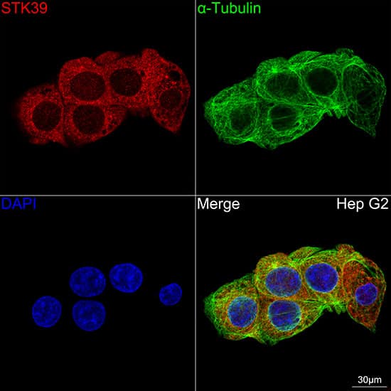 Immunocytochemistry/ Immunofluorescence: STK39 Antibody (0D9L5) [NBP3-16104] - Confocal imaging of Hep G2 cells using STK39 Rabbit mAb . The cells were counterstained with alpha-Tubulin Mouse mAb (Green). DAPI was used for nuclear staining (blue). DAPI was used for nuclear staining (blue). Objective: 100x.