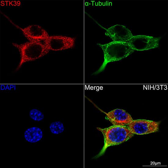 Immunocytochemistry/ Immunofluorescence: STK39 Antibody (0D9L5) [NBP3-16104] - Confocal imaging of NIH/3T3 cells using STK39 Rabbit mAb . The cells were counterstained with alpha-Tubulin Mouse mAb (Green). DAPI was used for nuclear staining (blue). Objective: 100x.