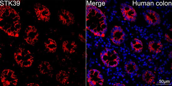 Immunocytochemistry/ Immunofluorescence: STK39 Antibody (0D9L5) [NBP3-16104] - Confocal imaging of human colon using STK39 Rabbit mAb . Objective: 40x. Perform high pressure antigen retrieval with 10 mM citrate buffer pH 6.0 before commencing with IF staining protocol.