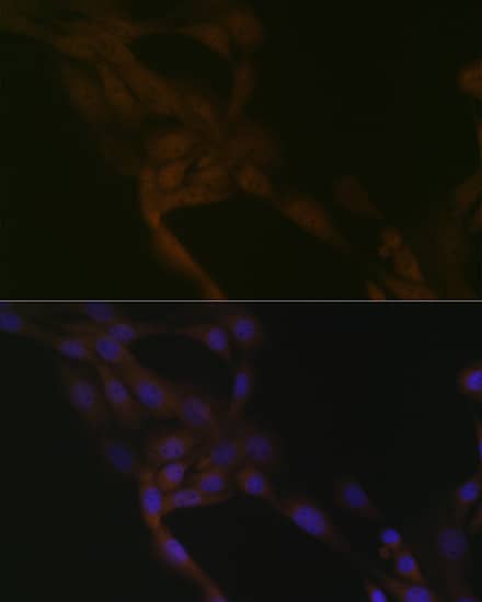 Immunocytochemistry/ Immunofluorescence: SMURF2 Antibody (8O7F0) [NBP3-16105] - Immunofluorescence analysis of NIH-3T3 cells using SMURF2 Rabbit mAb at dilution of 1:100 (40x lens). Secondary antibody: Cy3-conjugated Goat anti-Rabbit IgG (H+L) at 1:500 dilution. Blue: DAPI for nuclear staining.