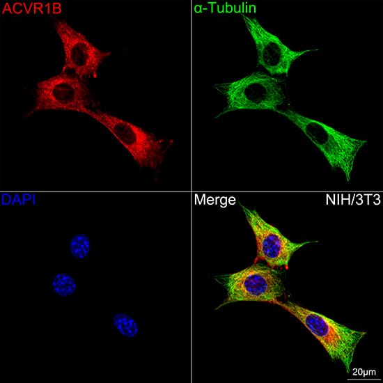 Immunocytochemistry/ Immunofluorescence: Activin RIB/ALK-4 Antibody (3U6I8) [NBP3-16106] - Confocal imaging of NIH/3T3 cells using Activin RIB/ALK-4 Rabbit mAb  followed by a further incubation with Cy3 Goat Anti-Rabbit IgG (H+L).The cells were counterstained with alpha-Tubulin Mouse mAb followed by incubation with ABflo(R) 488-conjugated Goat Anti-Mouse IgG (H+L) Ab (Green).DAPI was used for nuclear staining (Blue). Objective: 100x.