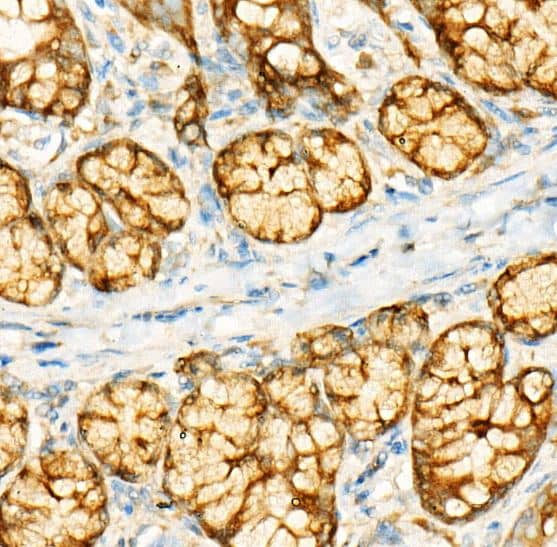 IHC-P-GCN2 Antibody (6E2X0) [NBP3-16112] -  Analysis of paraffin-embedded rat intestine using GCN2 Rabbit mAb at dilution of 1:500 (40x lens).Perform high pressure antigen retrieval with 10 mM citrate buffer pH 6.0 before commencing with IHC staining protocol.