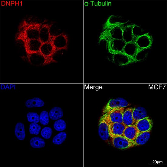 Immunocytochemistry/ Immunofluorescence: c-Myc-responsive protein Rcl Antibody (7C1Z8) [NBP3-16115] - Confocal imaging of MCF7 cells using c-Myc-responsive protein Rcl Rabbit mAb  followed by a further incubation with Cy3 Goat Anti-Rabbit IgG (H+L)  . The cells were counterstained with alpha-Tubulin Mouse mAb  followed by incubation with ABflo 488-conjugated Goat Anti-Mouse IgG (H+L) Ab  (Green). DAPI was used for nuclear staining (Blue). Objective: 100x.