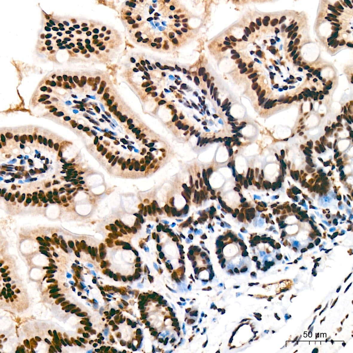 Immunohistochemistry: USP39 Antibody (1S9R9) [NBP3-16119] - Immunohistochemistry analysis of USP39 in paraffin-embedded mouse intestin tissue using USP39 Rabbit mAb  at a dilution of 1:200 (40x lens). High pressure antigen retrieval was performed with 0.01 M citrate buffer (pH 6.0) prior to IHC staining.