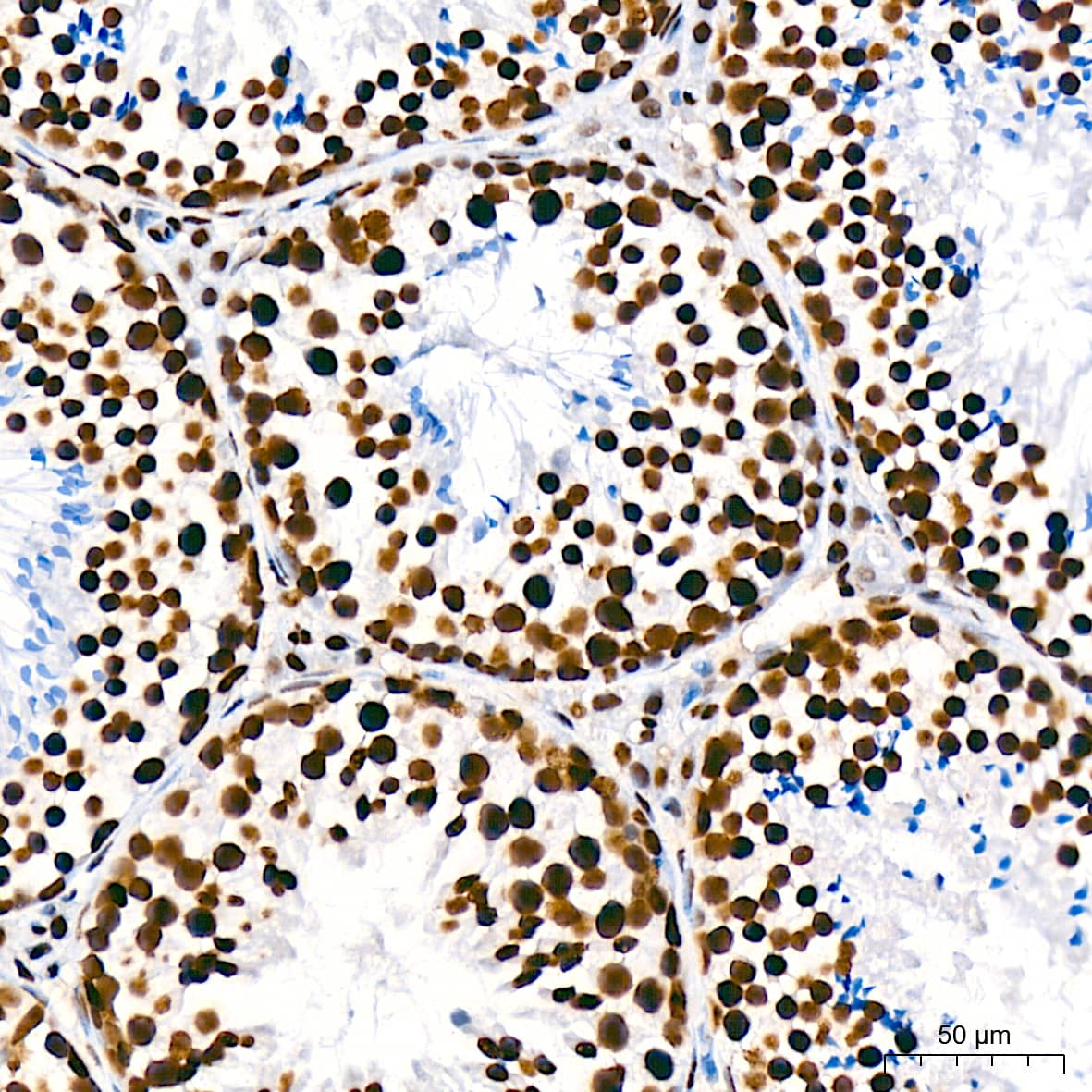 Immunohistochemistry: USP39 Antibody (1S9R9) [NBP3-16119] - Immunohistochemistry analysis of USP39 in paraffin-embedded mouse testis tissue using USP39 Rabbit mAb  at a dilution of 1:200 (40x lens). High pressure antigen retrieval was performed with 0.01 M citrate buffer (pH 6.0) prior to IHC staining.