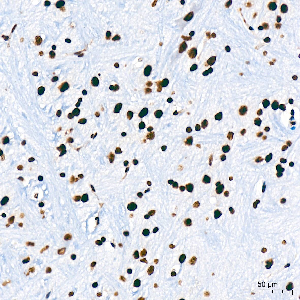 Immunohistochemistry: USP39 Antibody (1S9R9) [NBP3-16119] - Immunohistochemistry analysis of USP39 in paraffin-embedded mouse brain tissue using USP39 Rabbit mAb  at a dilution of 1:200 (40x lens). High pressure antigen retrieval was performed with 0.01 M citrate buffer (pH 6.0) prior to IHC staining.