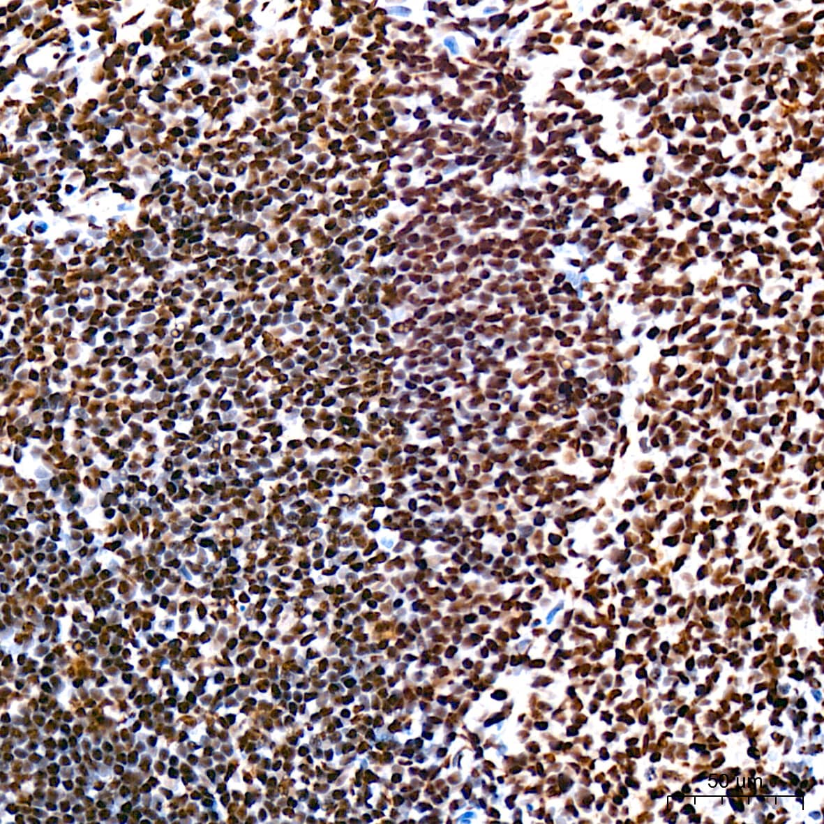 Immunohistochemistry: USP39 Antibody (1S9R9) [NBP3-16119] - Immunohistochemistry analysis of USP39 in paraffin-embedded rat spleen tissue using USP39 Rabbit mAb  at a dilution of 1:200 (40x lens). High pressure antigen retrieval was performed with 0.01 M citrate buffer (pH 6.0) prior to IHC staining.