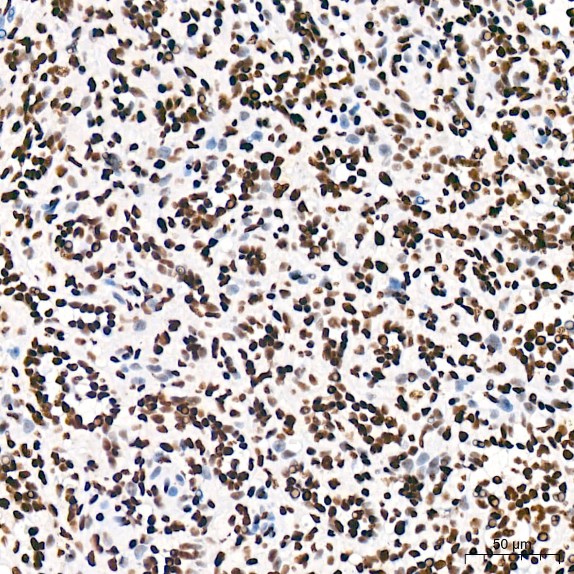 Immunohistochemistry: USP39 Antibody (1S9R9) [NBP3-16119] - Immunohistochemistry analysis of USP39 in paraffin-embedded human spleen tissue using USP39 Rabbit mAb  at a dilution of 1:200 (40x lens). High pressure antigen retrieval was performed with 0.01 M citrate buffer (pH 6.0) prior to IHC staining.