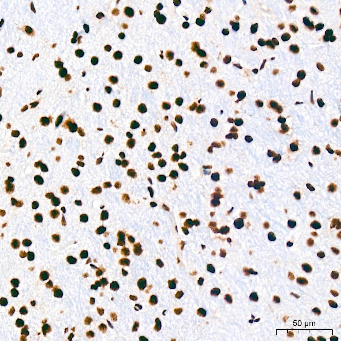 Immunohistochemistry: USP39 Antibody (1S9R9) [NBP3-16119] - Immunohistochemistry analysis of USP39 in paraffin-embedded rat brain tissue using USP39 Rabbit mAb  at a dilution of 1:200 (40x lens). High pressure antigen retrieval was performed with 0.01 M citrate buffer (pH 6.0) prior to IHC staining.