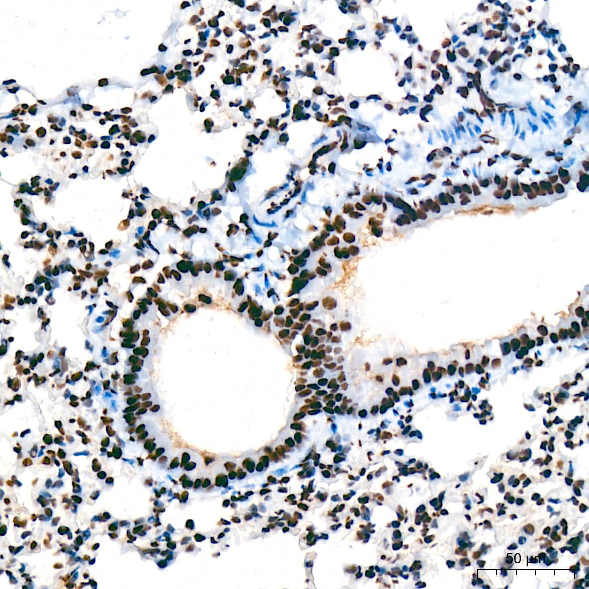 Immunohistochemistry: USP39 Antibody (1S9R9) [NBP3-16119] - Immunohistochemistry analysis of USP39 in paraffin-embedded mouse lung tissue using USP39 Rabbit mAb  at a dilution of 1:200 (40x lens). High pressure antigen retrieval was performed with 0.01 M citrate buffer (pH 6.0) prior to IHC staining.