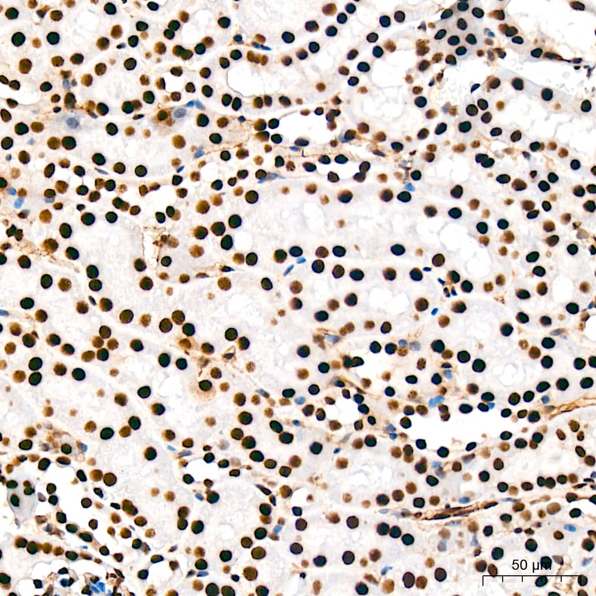 Immunohistochemistry: USP39 Antibody (1S9R9) [NBP3-16119] - Immunohistochemistry analysis of USP39 in paraffin-embedded mouse kidney tissue using USP39 Rabbit mAb  at a dilution of 1:200 (40x lens). High pressure antigen retrieval was performed with 0.01 M citrate buffer (pH 6.0) prior to IHC staining.