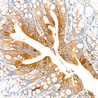 Immunohistochemistry-Paraffin: ROCK2 Antibody (8G3U2) [NBP3-16123] -  Analysis of paraffin-embedded Rat colon tissue using ROCK2 Rabbit mAb at a dilution of 1:200 (40x lens). High pressure antigen retrieval was performed with 0.01 M citrate buffer (pH 6.0) prior to IHC staining.