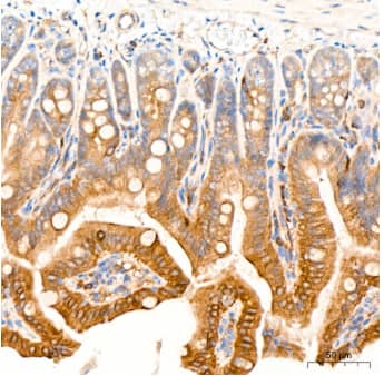 Immunohistochemistry-Paraffin: ROCK2 Antibody (8G3U2) [NBP3-16123] - Analysis of paraffin-embedded Mouse intestin tissue using ROCK2 Rabbit mAb at a dilution of 1:200 (40x lens). High pressure antigen retrieval was performed with 0.01 M citrate buffer (pH 6.0) prior to IHC staining.