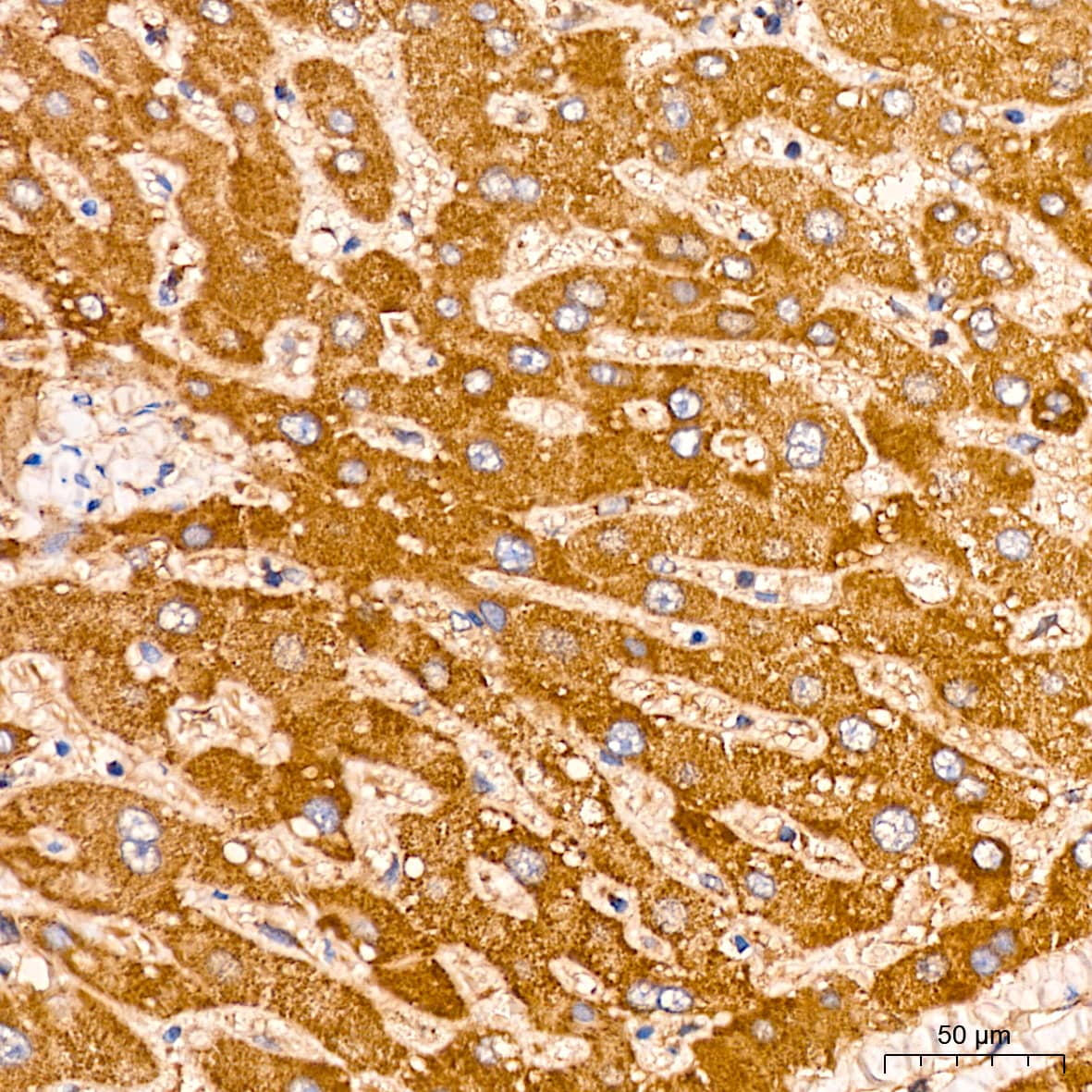 Immunohistochemistry: Peroxiredoxin 3 Antibody (4K7D1) [NBP3-16125] - Immunohistochemistry analysis of paraffin-embedded Human liver tissue using Peroxiredoxin 3 Rabbit mAb at a dilution of 1:200 (40x lens). High pressure antigen retrieval performed with 0.01M Citrate Bufferr (pH 6.0) prior to IHC staining.