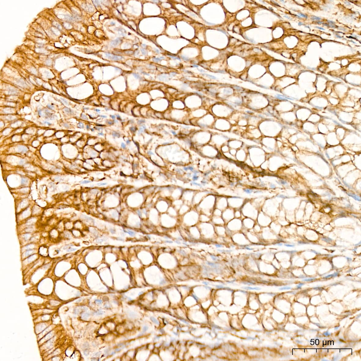 Immunohistochemistry: Alpha Fodrin Antibody (9H5V8) [NBP3-16131] - Immunohistochemistry analysis of Alpha Fodrin in paraffin-embedded rat colon tissue using Alpha Fodrin Rabbit mAb  at a dilution of 1:200 (40x lens). High pressure antigen retrieval was performed with 0.01 M citrate buffer (pH 6.0) prior to IHC staining.