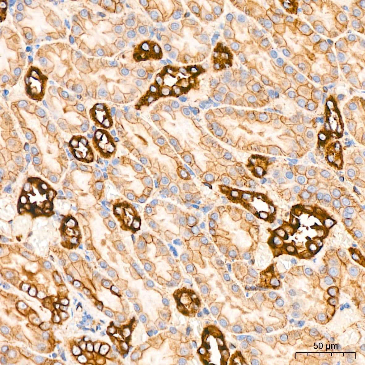 Immunohistochemistry: Alpha Fodrin Antibody (9H5V8) [NBP3-16131] - Immunohistochemistry analysis of Alpha Fodrin in paraffin-embedded rat kidney tissue using Alpha Fodrin Rabbit mAb  at a dilution of 1:200 (40x lens). High pressure antigen retrieval was performed with 0.01 M citrate buffer (pH 6.0) prior to IHC staining.