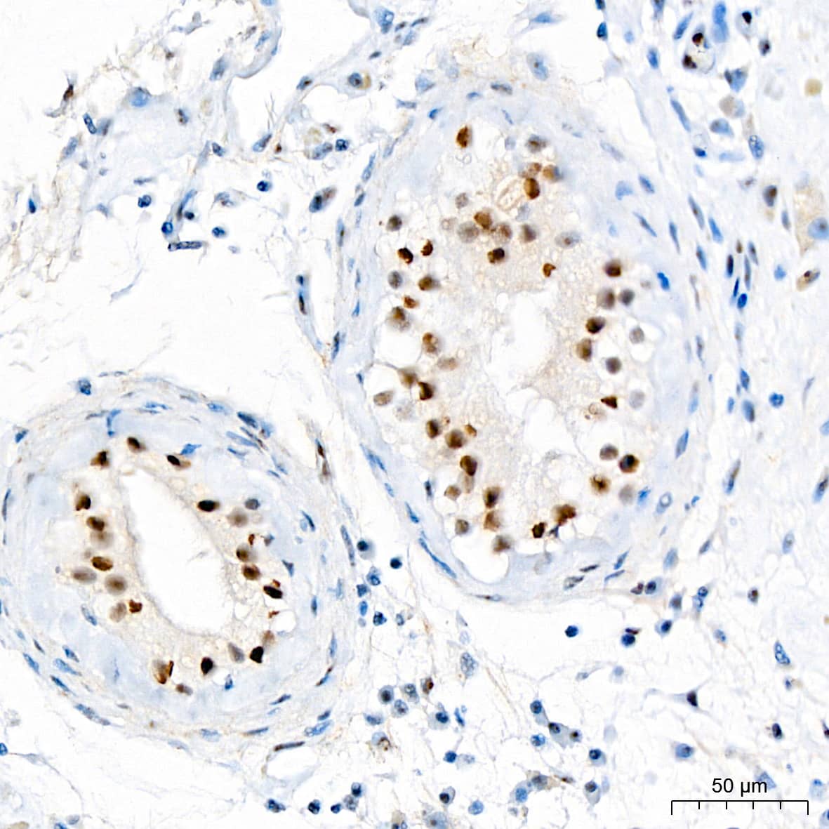 Immunohistochemistry: WT1 Antibody (6L9X6) [NBP3-16135] - Immunohistochemistry analysis of paraffin-embedded Human testis tissue using WT1 Rabbit mAb at a dilution of 1:200 (40x lens). High pressure antigen retrieval performed with 0.01M Citrate Buffer (pH 6.0) prior to IHC staining.