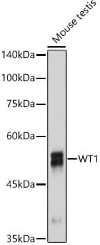 Western Blot: WT1 Antibody (6L9X6) [NBP3-16135] - Western blot analysis of lysates from Mouse testis using WT1 Rabbit mAb at 1:1000 dilution incubated overnight at 4C.Secondary antibody: HRP-conjugated Goat anti-Rabbit IgG (H+L) at 1:10000 dilution.Lysates/proteins: 25ug per lane.Blocking buffer: 3% nonfat dry milk in TBST.Detection: ECL Basic Kit.Exposure time: 90s.