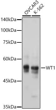 Western Blot: WT1 Antibody (6L9X6) [NBP3-16135] - Western blot analysis of various lysates using WT1 Rabbit mAb at 1:1000 dilution incubated overnight at 4C.Secondary antibody: HRP-conjugated Goat anti-Rabbit IgG (H+L) at 1:10000 dilution.Lysates/proteins: 25ug per lane.Blocking buffer: 3% nonfat dry milk in TBST.Detection: ECL Basic Kit.Exposure time: 1s.