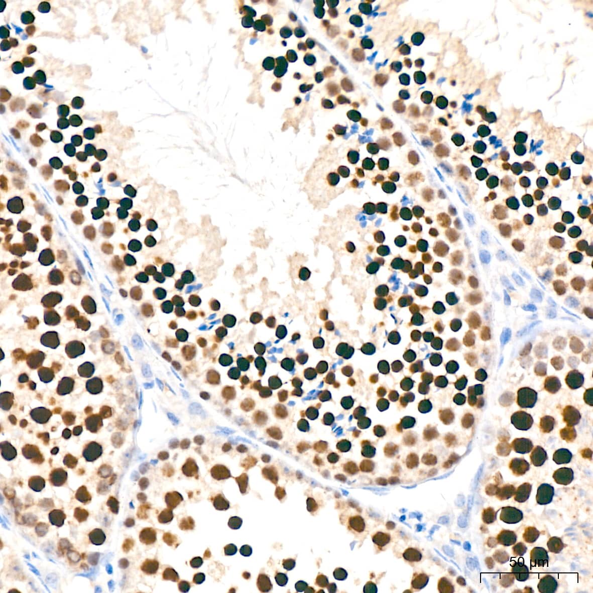 Immunohistochemistry: Nup153 Antibody (3I5V3) [NBP3-16136] - Immunohistochemistry analysis of Nup153 in paraffin-embedded mouse testis tissue using Nup153 Rabbit mAb at a dilution of 1:200 (40x lens).High pressure antigen retrieval was performed with 0.01 M citrate buffer (pH 6.0) prior to IHC staining.