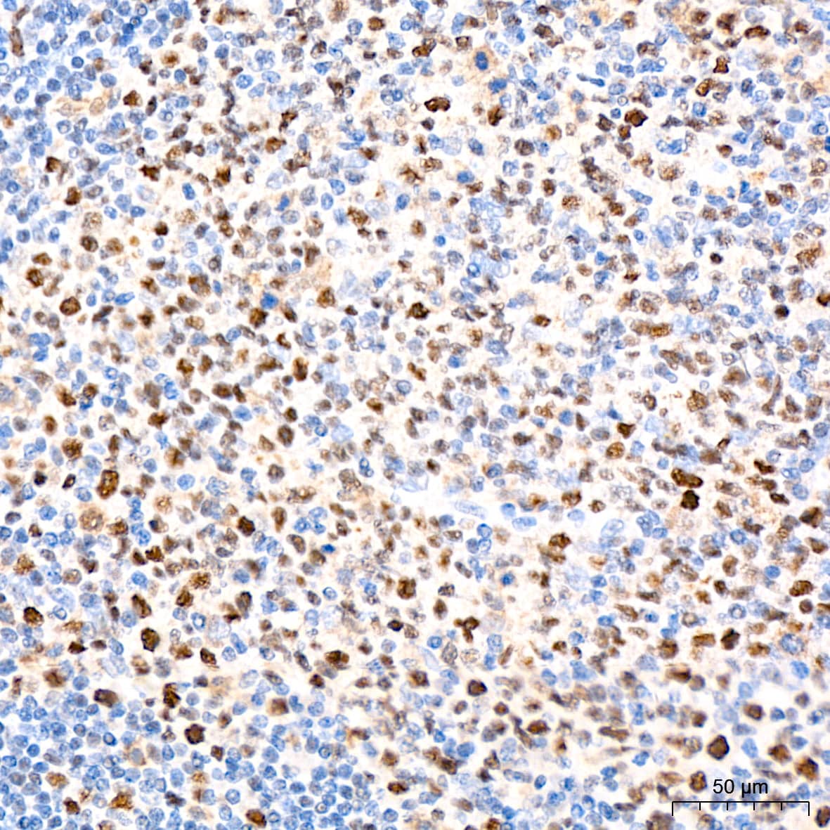 Immunohistochemistry: Nup153 Antibody (3I5V3) [Nup153] - Immunohistochemistry analysis of Nup153 in paraffin-embedded human tonsil tissue using Nup153 Rabbit mAb  at a dilution of 1:200 (40x lens).High pressure antigen retrieval was performed with 0.01 M citrate buffer (pH 6.0) prior to IHC staining.