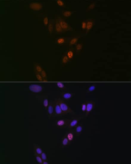 Immunocytochemistry/ Immunofluorescence: Nup153 Antibody (3I5V3) [Nup153] - Immunofluorescence analysis of U-2 OS cells using Nup153 Rabbit mAb  at dilution of 1:100 (40x lens). Secondary antibody: Cy3 Goat Anti-Rabbit IgG (H+L)  at 1:500 dilution. Blue: DAPI for nuclear staining.