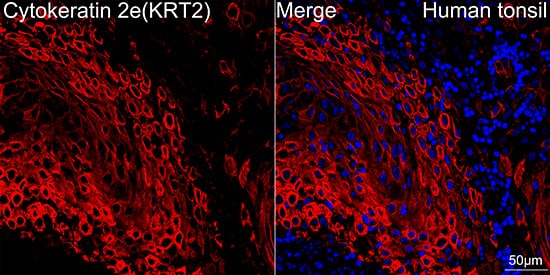 Immunocytochemistry/ Immunofluorescence: Cytokeratin 2 Antibody (9T3Q2) [NBP3-16139] - Confocal imaging of paraffin-embedded Human tonsil tissue using Cytokeratin 2 Rabbit mAb followed by a further incubation with Cy3 Goat Anti-Rabbit IgG (H+L) . DAPI was used for nuclear staining (Blue). Objective: 40x. Perform high pressure antigen retrieval with 0.01 M citrate buffer (pH 6.0) prior to IF staining.