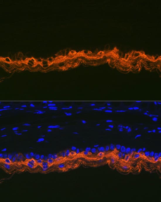 Immunocytochemistry/ Immunofluorescence: Cytokeratin 2 Antibody (9T3Q2) [NBP3-16139] - Immunofluorescence analysis of paraffin-embedded mouse skin using Cytokeratin 2 Rabbit mAb at dilution of 1:100 (40x lens). Secondary antibody: Cy3-conjugated Goat anti-Rabbit IgG (H+L) at 1:500 dilution. Blue: DAPI for nuclear staining.