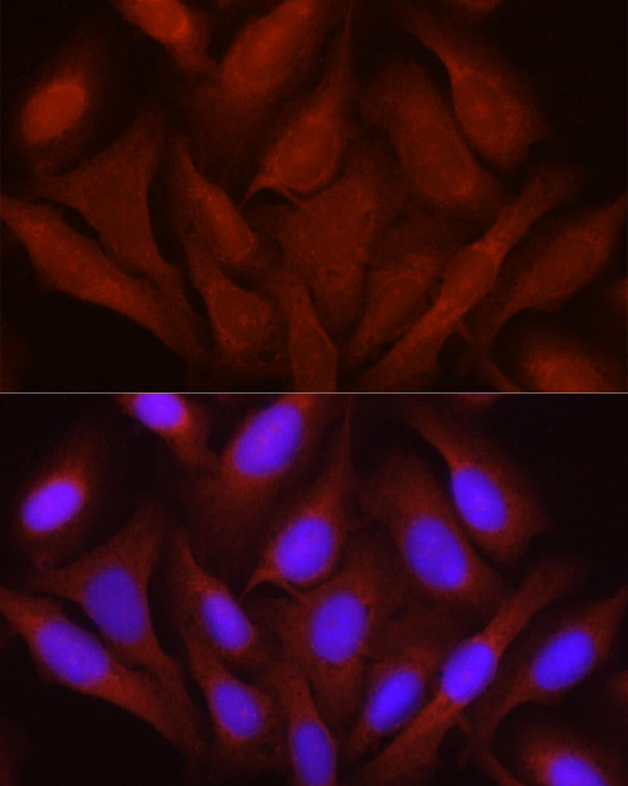 Immunocytochemistry/ Immunofluorescence: JNK1/2/3 Antibody - Azide and BSA Free [NBP3-16148] - Immunofluorescence analysis of U2OS cells using JNK1/2/3 Rabbit pAb at dilution of 1:100 (40x lens). Secondary antibody: Cy3 Goat Anti-Rabbit IgG (H+L) at 1:500 dilution. Blue: DAPI for nuclear staining.