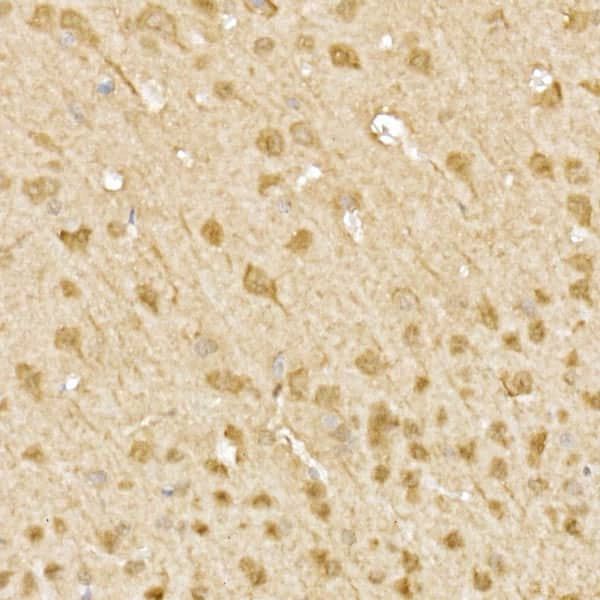 Immunohistochemistry: JNK1/2/3 Antibody - Azide and BSA Free [NBP3-16148] - Immunohistochemistry analysis of paraffin-embedded mouse brain using JNK1/2/3 Rabbit pAb at dilution of 1:100 (40x lens).Perform high pressure antigen retrieval with 10 mM citrate buffer pH 6.0 before commencing with IHC staining protocol.