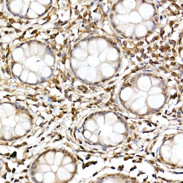 Immunohistochemistry: JNK1/2/3 Antibody - Azide and BSA Free [NBP3-16148] - Immunohistochemistry analysis of paraffin-embedded human colon using JNK1/2/3 Rabbit pAb at dilution of 1:100 (40x lens).Perform high pressure antigen retrieval with 10 mM citrate buffer pH 6.0 before commencing with IHC staining protocol.