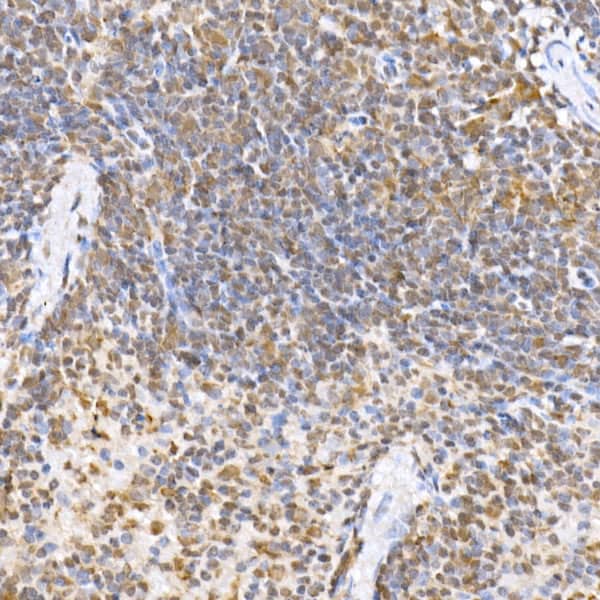 Immunohistochemistry: JNK1/2/3 Antibody - Azide and BSA Free [NBP3-16148] - Immunohistochemistry analysis of paraffin-embedded mouse spleen using JNK1/2/3 Rabbit pAb at dilution of 1:100 (40x lens).Perform high pressure antigen retrieval with 10 mM citrate buffer pH 6.0 before commencing with IHC staining protocol.