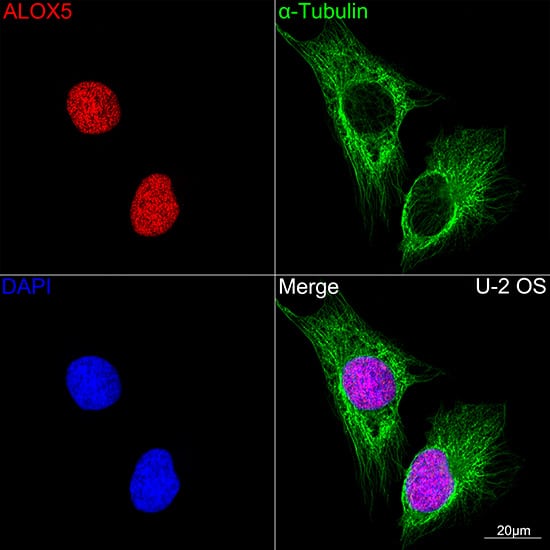Immunocytochemistry/ Immunofluorescence: 5-Lipoxygenase Antibody (5C5Z2) [NBP3-16150] - Confocal imaging of U-2 OS cells using 5-Lipoxygenase Rabbit mAb. The cells were counterstained with alpha-Tubulin Mouse mAb (Green). DAPI was used for nuclear staining (blue). Objective: 100x.