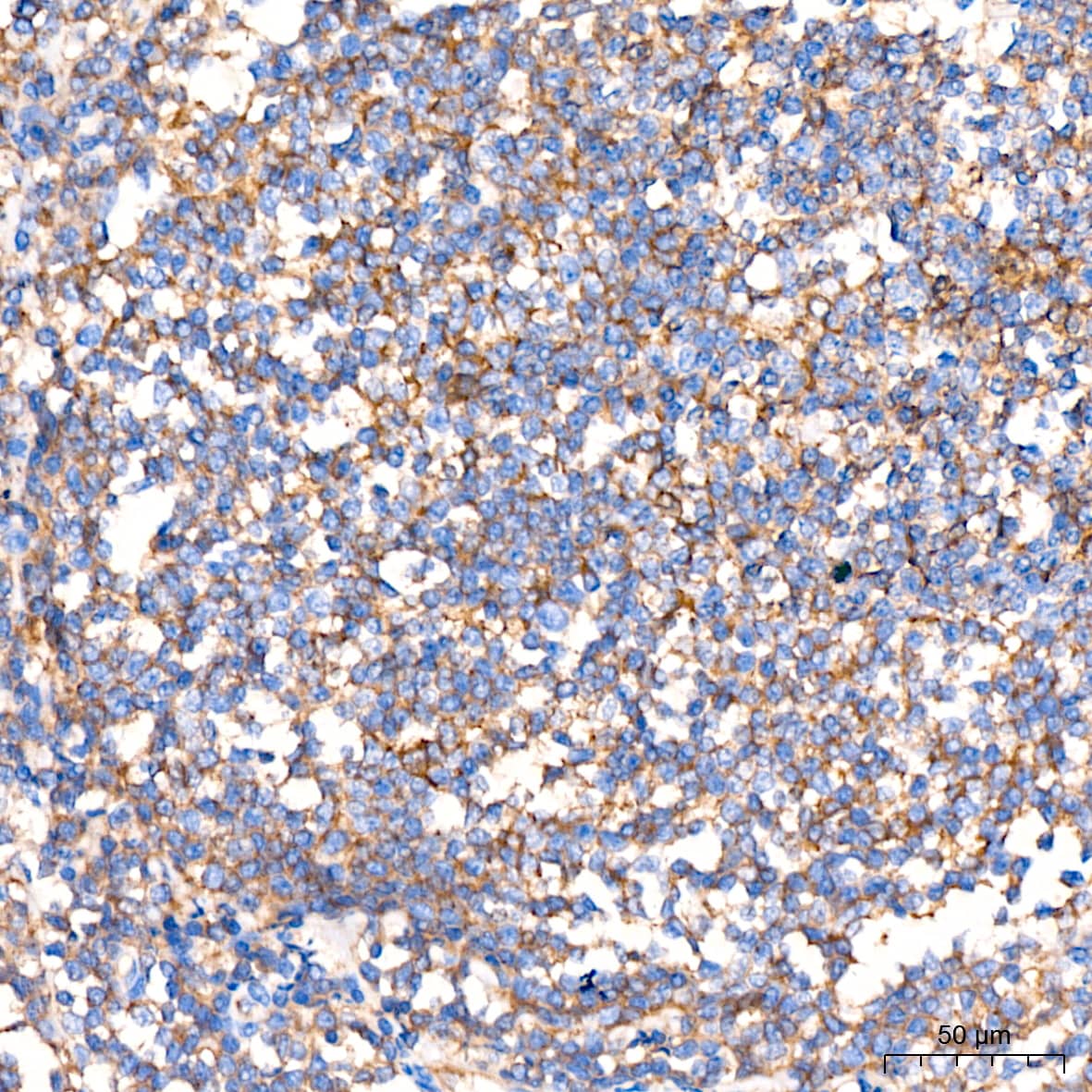 Immunohistochemistry: Flotillin-1 Antibody (8I2S7) [NBP3-16152] - Immunohistochemistry analysis of paraffin-embedded Human tonsil tissue using Flotillin-1 Rabbit mAb at a dilution of 1:200 (40x lens). High pressure antigen retrieval performed with 0.01M Citrate Bufferr (pH 6.0) prior to IHC staining.