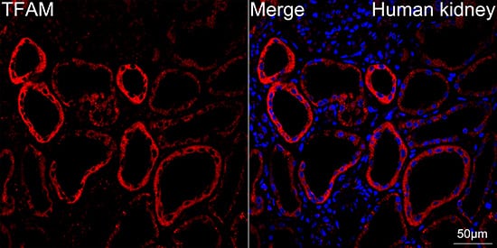 Immunocytochemistry/ Immunofluorescence: mtTFA Antibody (4H2M9) [NBP3-16154] - Confocal imaging of paraffin-embedded Human kidney tissue using mtTFA Rabbit mAb followed by a further incubation with Cy3 Goat Anti-Rabbit IgG (H+L) . DAPI was used for nuclear staining (Blue). Objective: 40x. Perform high pressure antigen retrieval with 0.01 M citrate buffer (pH 6.0) prior to IF staining.