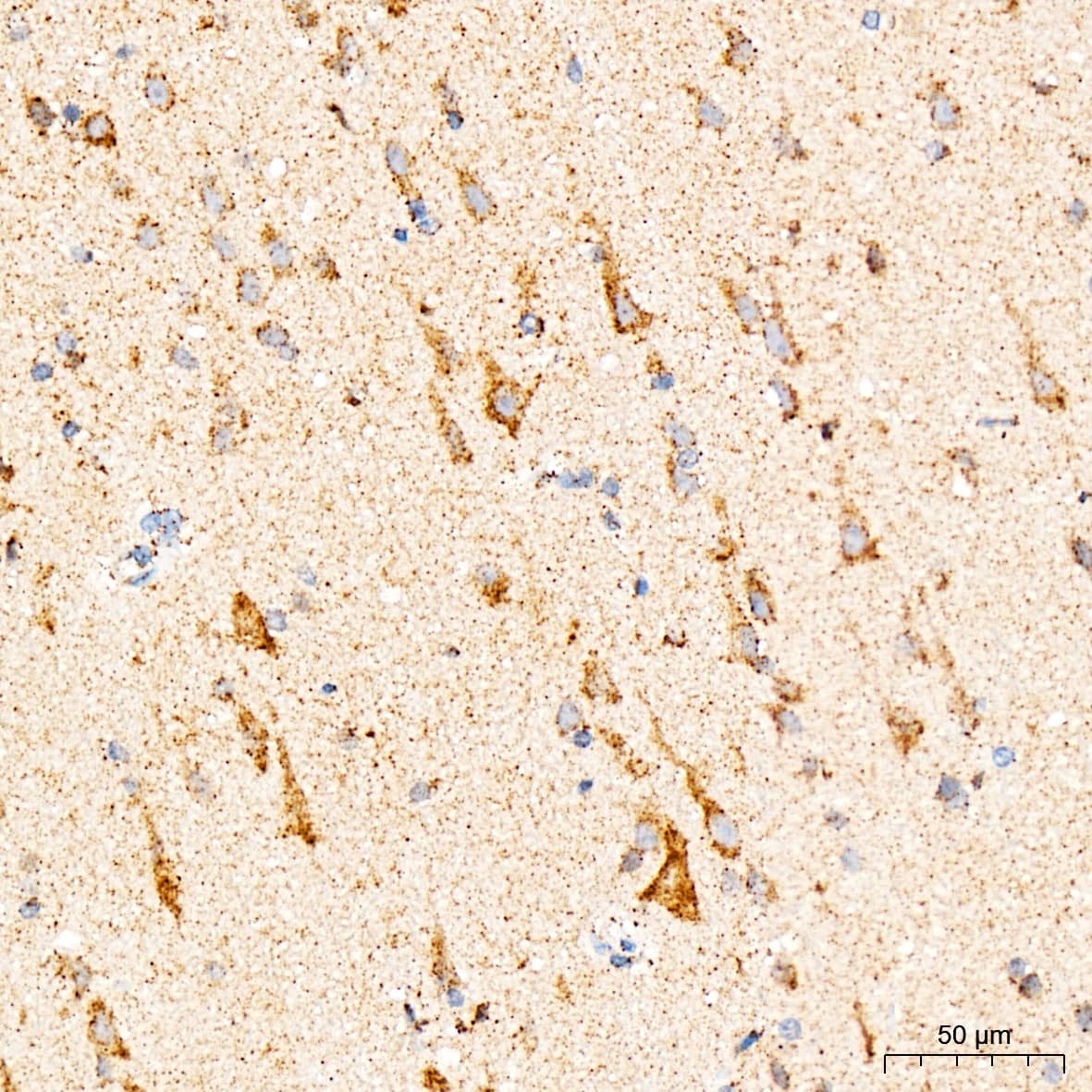 Immunohistochemistry: mtTFA Antibody (4H2M9) [NBP3-16154] - Immunohistochemistry analysis of paraffin-embedded Human brain tissue using mtTFA Rabbit mAb at a dilution of 1:1000 (40x lens). High pressure antigen retrieval was performed with 0.01 M citrate buffer (pH 6.0) prior to IHC staining.