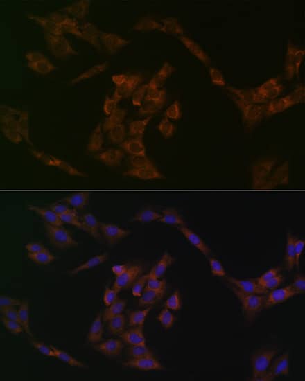 Immunocytochemistry/ Immunofluorescence: IRF6 Antibody (5D1Z4) [NBP3-16155] - Immunofluorescence analysis of C6 cells using IRF6 Rabbit mAb  at dilution of 1:100 (40x lens). Secondary antibody: Cy3 Goat Anti-Rabbit IgG (H+L)  at 1:500 dilution. Blue: DAPI for nuclear staining.