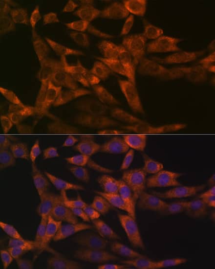 Immunocytochemistry/ Immunofluorescence: IRF6 Antibody (5D1Z4) [NBP3-16155] - Immunofluorescence analysis of NIH-3T3 cells using IRF6 Rabbit mAb  at dilution of 1:100 (40x lens). Secondary antibody: Cy3 Goat Anti-Rabbit IgG (H+L)  at 1:500 dilution. Blue: DAPI for nuclear staining.