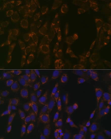 Immunocytochemistry/ Immunofluorescence: CLPP Antibody (1W6O4) [NBP3-16156] - Immunofluorescence analysis of NIH/3T3 cells using CLPP Rabbit mAb at dilution of 1:100 (40x lens). Secondary antibody: Cy3 Goat Anti-Rabbit IgG (H+L) at 1:500 dilution. Blue: DAPI for nuclear staining.