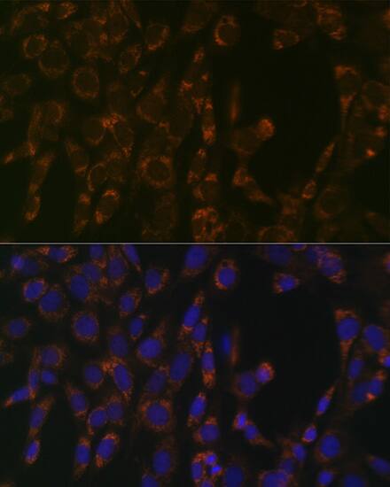 Immunocytochemistry/ Immunofluorescence: CLPP Antibody (1W6O4) [CLPP] - Immunofluorescence analysis of NIH/3T3 cells using CLPP Rabbit mAb  at dilution of 1:100 (40x lens). Secondary antibody: Cy3 Goat Anti-Rabbit IgG (H+L)  at 1:500 dilution. Blue: DAPI for nuclear staining.