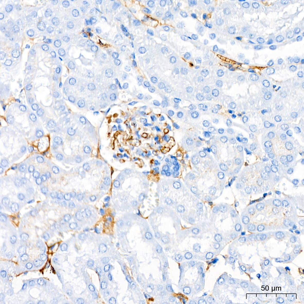 Immunohistochemistry: Cadherin-13 Antibody (4Z8D1) [NBP3-16158] - Immunohistochemistry analysis of Cadherin-13 in paraffin-embedded mouse kidney tissue using Cadherin-13 Rabbit mAb  at a dilution of 1:200 (40x lens).High pressure antigen retrieval was performed with 0.01 M citrate buffer (pH 6.0) prior to IHC staining.