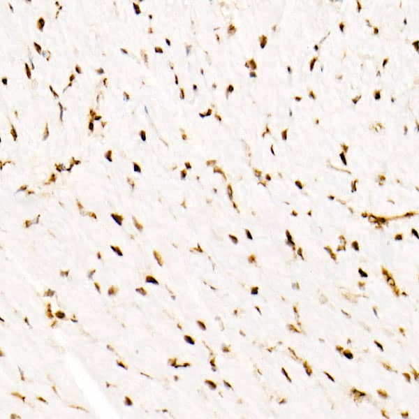 Immunohistochemistry: SNF5 Antibody (9A9G0) [NBP3-16159] - Immunohistochemistry analysis of paraffin-embedded Mouse heart using [KO Validated] SNF5 Rabbit mAb at dilution of 1:100 (40x lens). High pressure antigen retrieval performed with 0.01M Tris/EDTA Buffer (pH 9.0) prior to IHC staining.