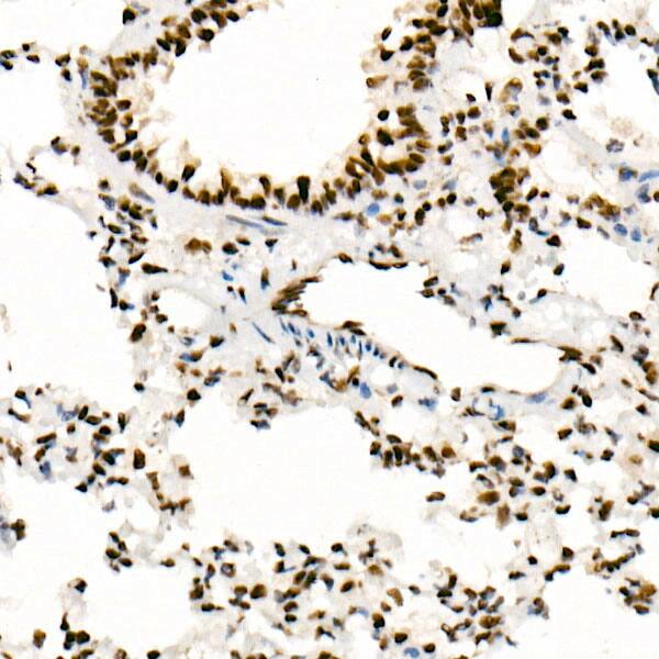 Immunohistochemistry: SNF5 Antibody (9A9G0) [NBP3-16159] - Immunohistochemistry analysis of paraffin-embedded Rat lung using [KO Validated] SNF5 Rabbit mAb at dilution of 1:100 (40x lens). High pressure antigen retrieval performed with 0.01M Tris/EDTA Buffer (pH 9.0) prior to IHC staining.