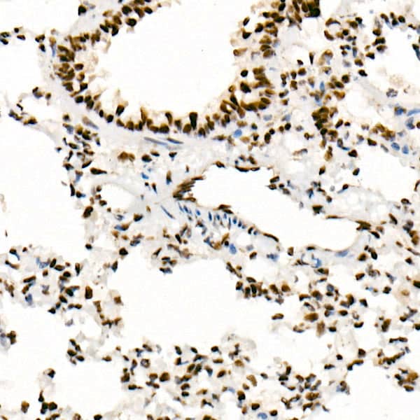 Immunohistochemistry: SNF5 Antibody (9A9G0) [SNF5] - Immunohistochemistry analysis of paraffin-embedded Rat lung using [KO Validated] SNF5 Rabbit mAb  at dilution of 1:100 (40x lens). High pressure antigen retrieval performed with 0.01M Tris/EDTA Buffer (pH 9.0) prior to IHC staining.