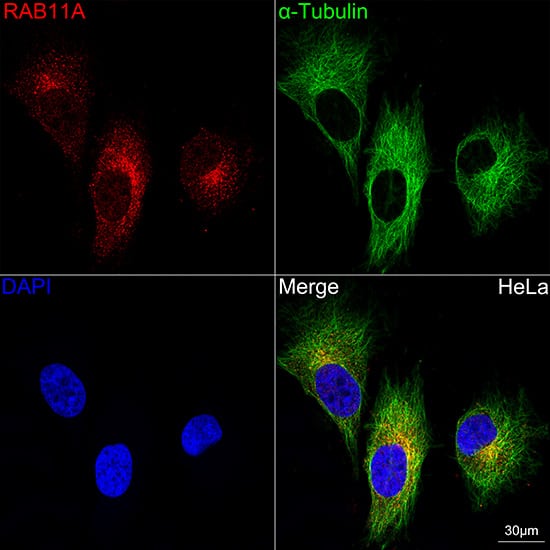 Immunocytochemistry/ Immunofluorescence: Rab11A Antibody (3O4R8) [NBP3-16160] - Confocal imaging of HeLa cells using Rab11A Rabbit mAb .The cells were counterstained with alpha-Tubulin Rabbit mAb (Green). DAPI was used for nuclear staining (blue). Objective: 60x.