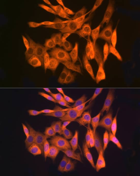 Immunocytochemistry/ Immunofluorescence: GLI-3 Antibody (8B1E2) [NBP3-16166] - Immunofluorescence analysis of NIH/3T3 cells using GLI-3 Rabbit mAb  at dilution of 1:100 (40x lens). Blue: DAPI for nuclear staining.